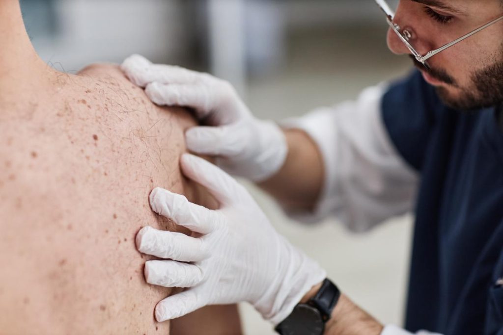 Visita dermatologo Villa d'Agri