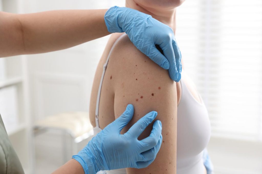 Dermatologia Val d'Agri