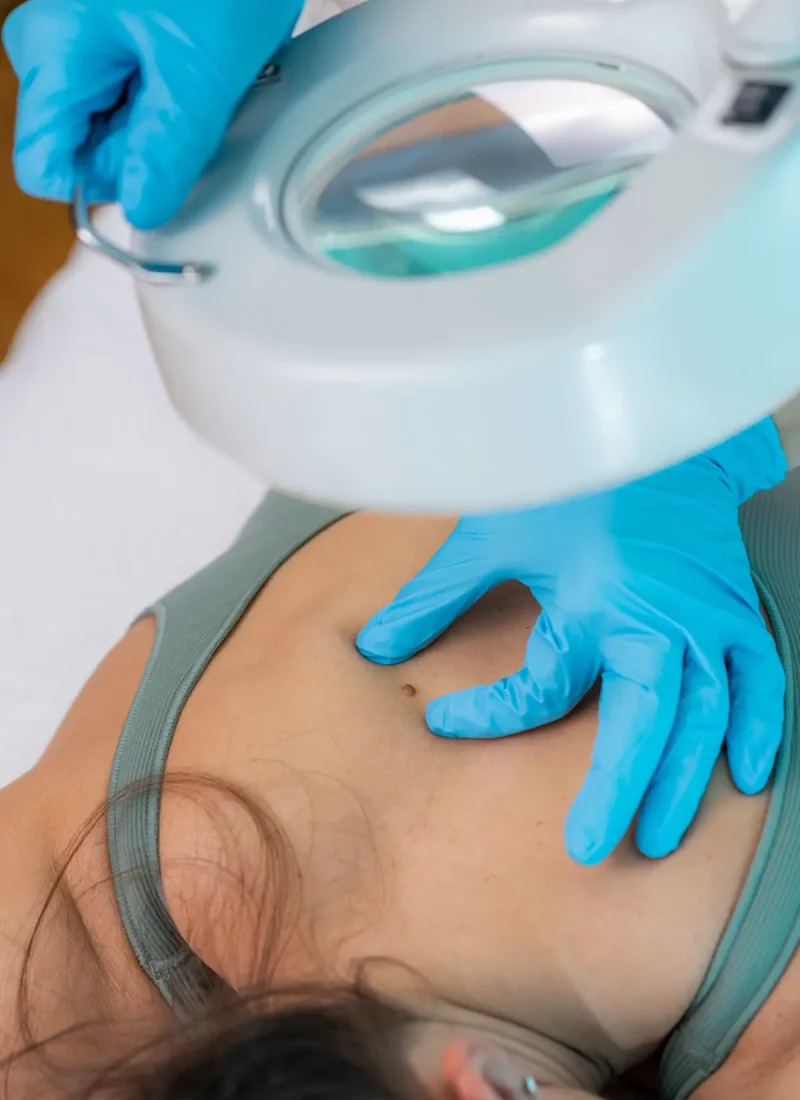 Esami dermatologici a Villa d'Agri