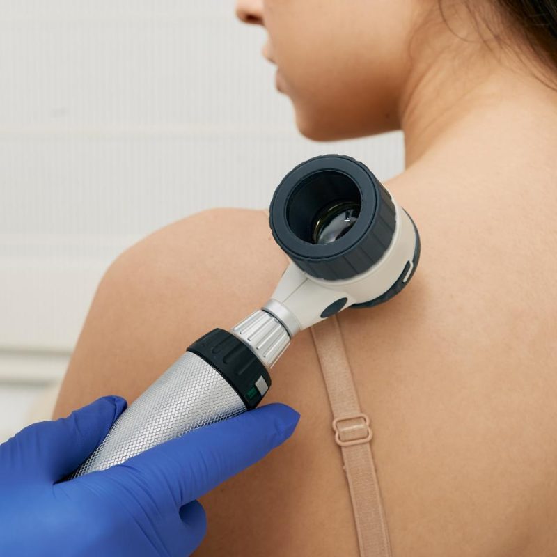 Visita dermatologica Villa d'Agri